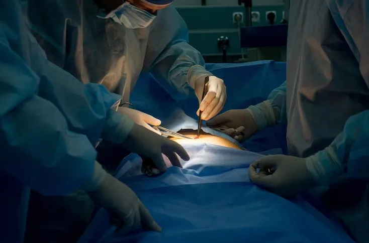 Best Abdominal Surgeries in Chennai – Trusted Care for Surgical Excellence