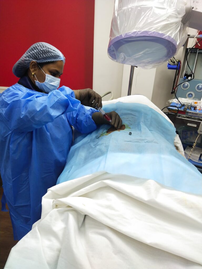 PRP Treatment