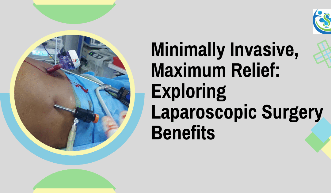 Minimally Invasive, Maximum Relief: Exploring Laparoscopic Surgery Benefits