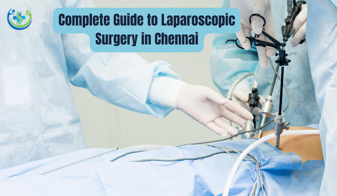 Complete Guide to Laparoscopic Surgery in Chennai