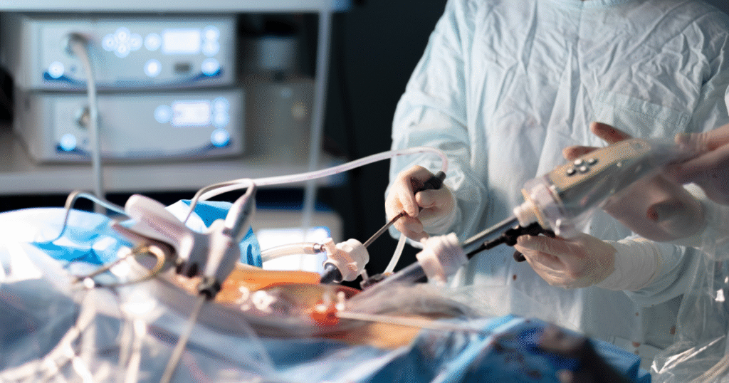 Types of Laparoscopic Surgery Chennai