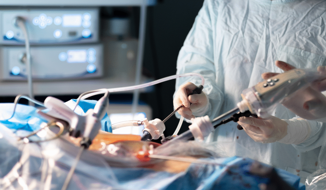 Types of Laparoscopic Surgery Chennai