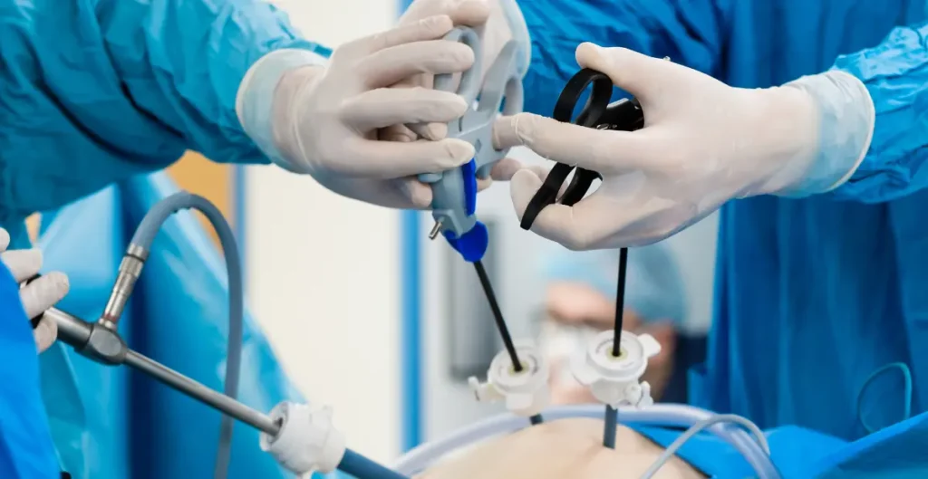 Laparoscopic Surgery
