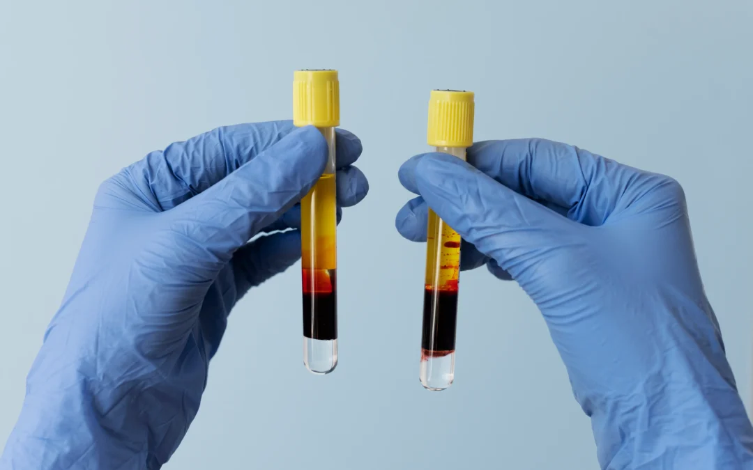 Revolutionizing Foot Ulcer Treatment: The Power of Platelet-Rich Plasma