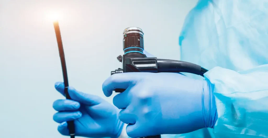 Endoscopy in Chennai