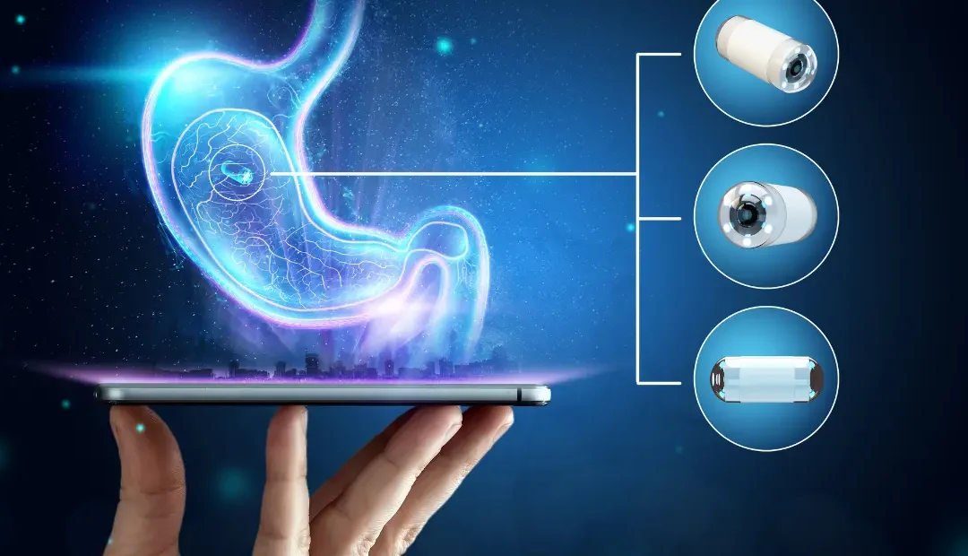 Endoscopy in Chennai - How do check