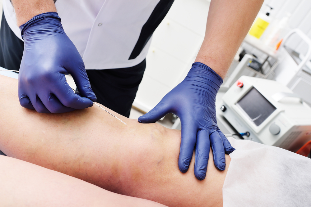 Laparoscopic surgery in chennai